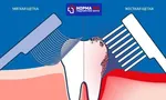 Самая частая ошибка пациентов при чистке зубов
